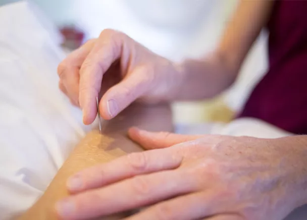 L’acupuncture, un traitement qui vient en complément d’autres soins.