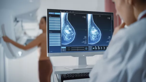 Mammographie de dépistage du cancer du sein